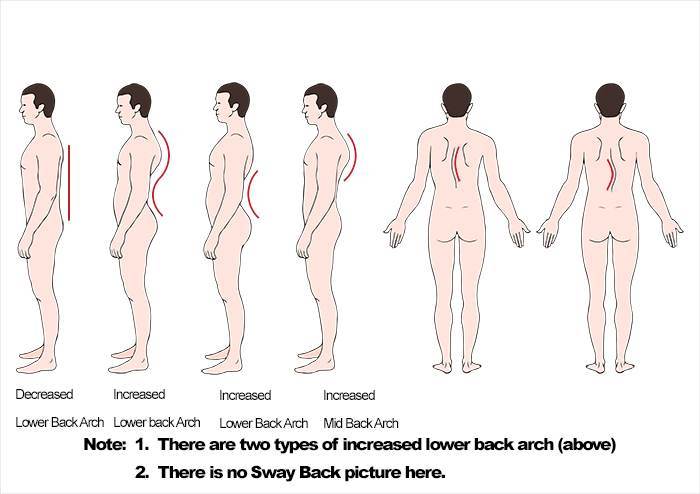 https://www.bodiempowerment.com/wp-content/uploads/2013/07/F-Different-Postures-from-the-Side.jpg